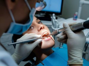 le processus de la pose d'un inlay dentaire : ce qu'il faut savoir